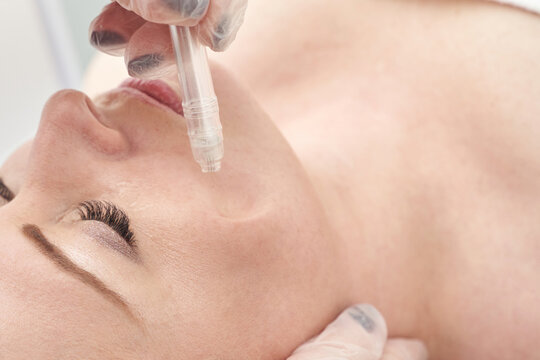 Female caucasian adult receiving professional facial skin care treatment with advanced microdermabrasion technique.