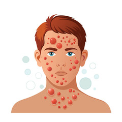 Skin conditions vector illustration