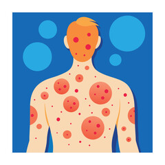 Skin conditions vector illustration