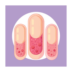 Skin conditions vector illustration