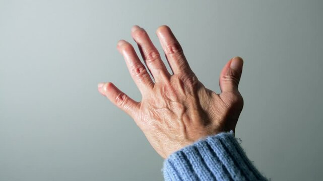 Elderly woman's severely deformed hand exposing painful rheumatoid arthritis symptoms affecting joint mobility with visible finger structural changes