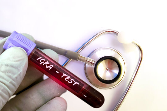 Blood sample for IGRA(interferon gamma release assay) test for diagnosis of Tuberculosis.