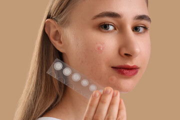 Young woman with acne problem and pimple patches on beige background, closeup
