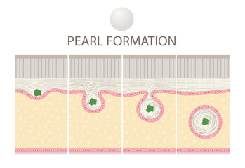 Pearl Formation in Bivalve Molluscs © Aldona
