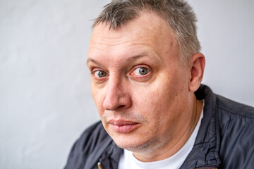 Obraz premium distorted face of sad and grieved very upset person, dissatisfied with his hard fate