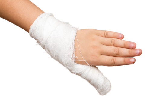 Little girls child hand with gauze bandage and broken thumb finger isolated on white background.