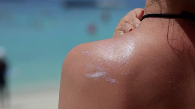 Woman carefully applying protective sunscreen on shoulder, safeguarding skin from harmful ultraviolet rays during relaxing beach vacation