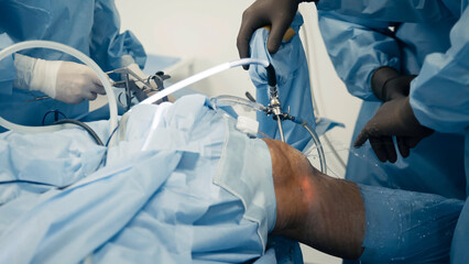 The surgeon performs endoscopic manipulations on the kneecap. The doctor performs arthroscopic...