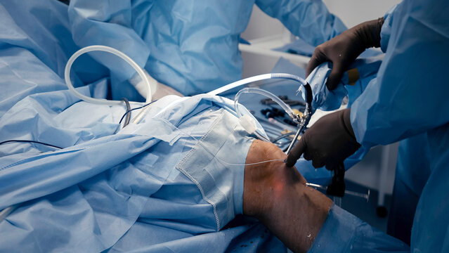 The surgeon performs endoscopic manipulations on the kneecap. The doctor performs arthroscopic surgery on the knee or joint in the operating room using modern arthroscopic instruments.