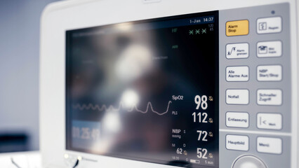 Close-up of a heart rate monitor in use during surgery. Vital signs displayed on a hospital screen, showing ECG readings on an anesthesia monitor. Medical equipment monitoring health during surgery.