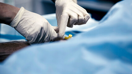 Close-up of an IV in the operating room. Preparing the patient for operating and surgical procedures. The concept of modern surgery, pharmaceuticals and comfortable medicine.