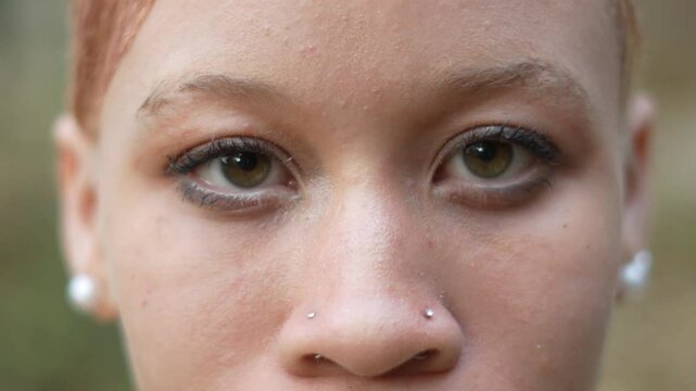 close-up of the eyes of a young African American albino girl with nystagmus