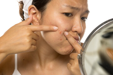Young asian woman Squeezing pimple.