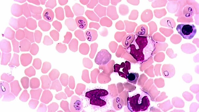 Babesia canis parasite in dog under microscope 