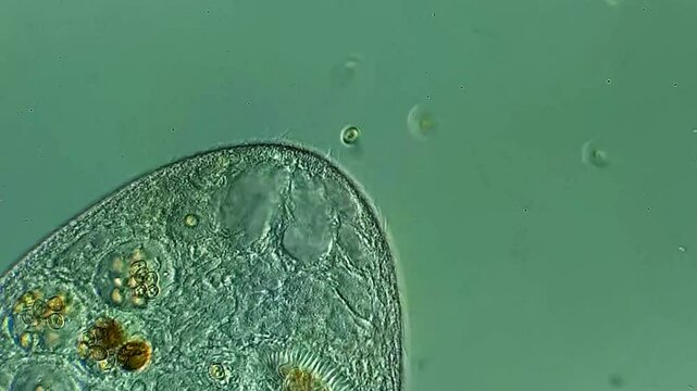 Ciliates under DIC microscope 