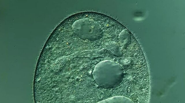 Ciliates under DIC microscope  - Powered by Adobe