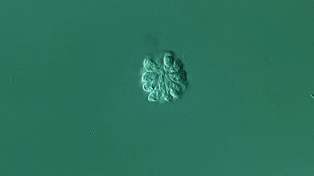 Synura under DIC microscope 