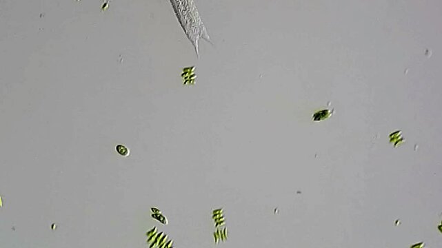 Movement of Gastrotricha under microscope 