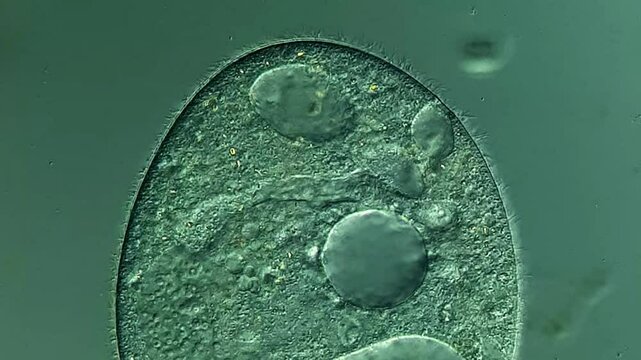 Ciliates under DIC microscope 