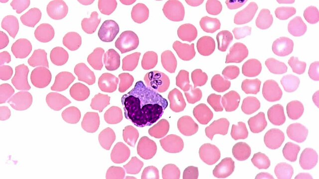 Babesia canis parasite with Wright stain 
