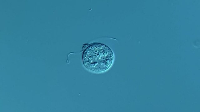 Giardia or other microorganism under microscope 