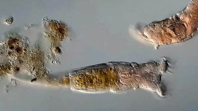 Movement of Rotifer under microscope view 