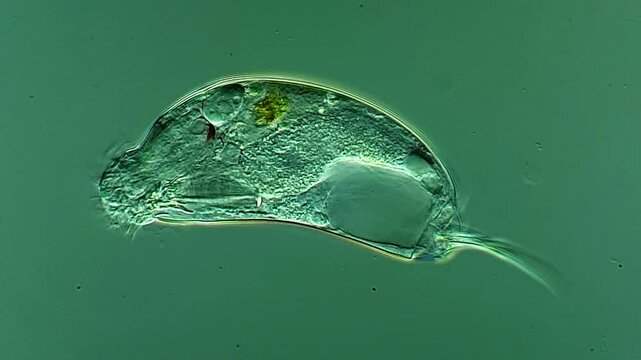 Rotifer under DIC microscope 