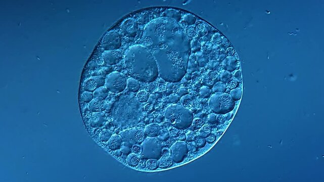 Ciliates under DIC microscope 