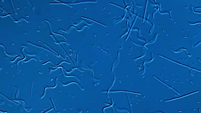 Movement of Spirochetes under microscope 