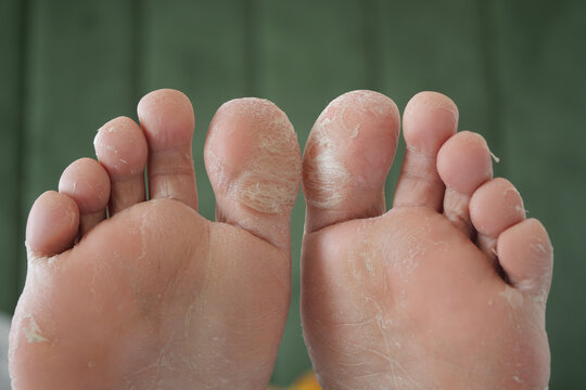 close up of young man dry feet on bed ,