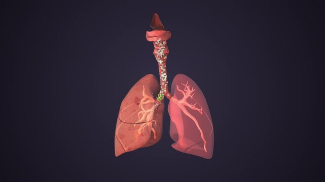 Lung Collapse Condition Affecting Air Exchange Efficiency
