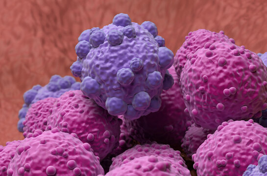 Lymphoma cells - closeup view 3d illustration