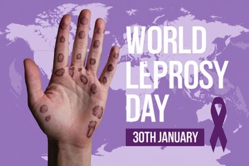 World Leprosy Day, 30th January:  Raise awareness, fight stigma, end leprosy.