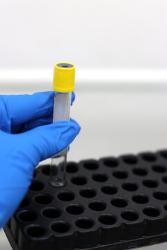 A tube with a biological sample is placed in a tray for research.