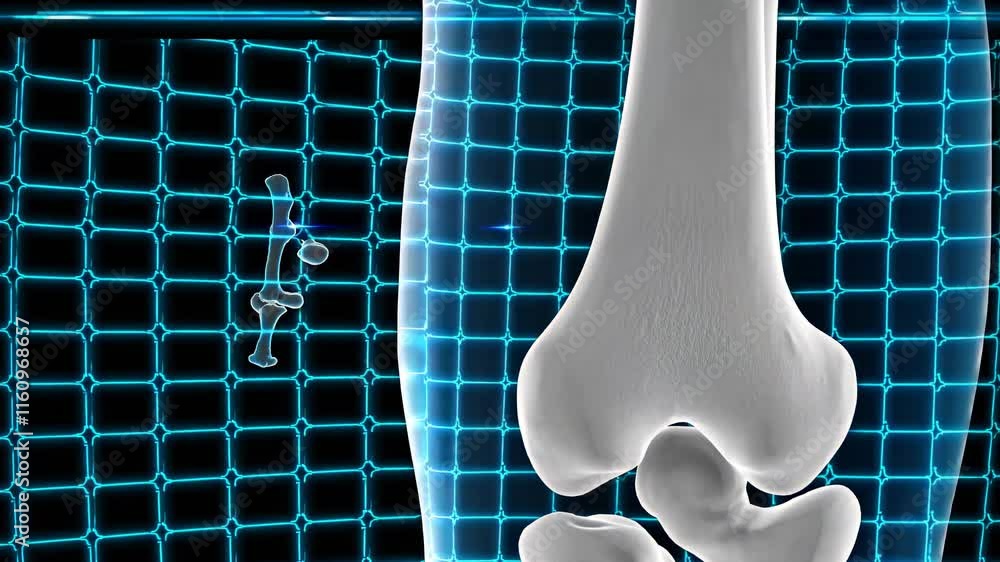 Poster understanding bone structure through detailed 3d visualization in a medical setting