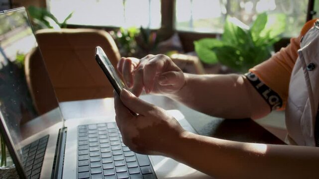 Hands of a woman with vitiligo on her skin are using a smartphone. Fingers with patchy of the pigmented girl are holding the phone. Female with melanin deficiency, autoimmune disease, dermatology