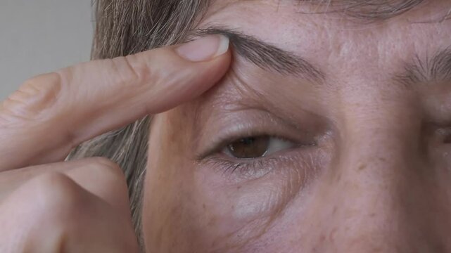 Close-up of a woman's face with grey hair, examining her bags under her eyes and swollen upper eyelids. Concept of plastic surgery of the face, eyelid lift, blepharoplasty, cosmetology, lymphatic drai