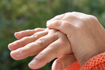 closeup female hands 55 years old with dry skin damage, applying moisturizer, concept care aging...