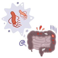 大腸菌に感染した腸のイラスト