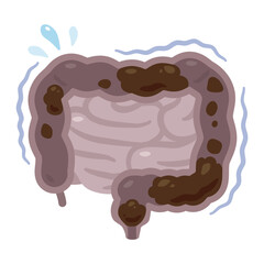 動きが鈍く便が滞った腸のイラスト