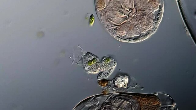 Movement of Euglena and rotifer under microscopy 