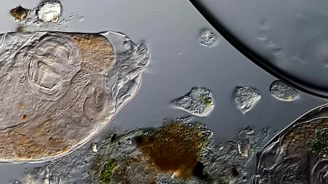 Rotifer and euglena under microscopy view 
