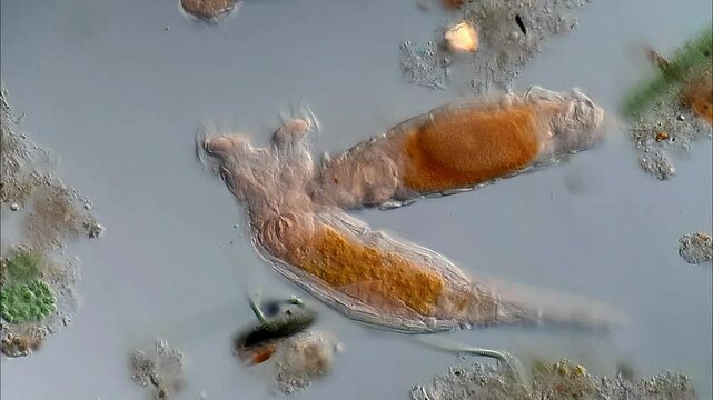 Rotifer under DIC microscope 