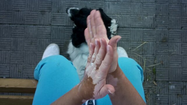 Woman hand with vitiligo uses a white cream. Girl palm rubs the lotion over the skin. Autoimmune disease, lack of melanin. Pigmentation disorder