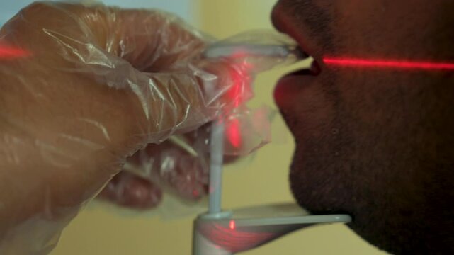 This video shows the apparatus placed inside the mouth and the mouth-jaw region during dental filming with a dental tomography (CBCT) device.