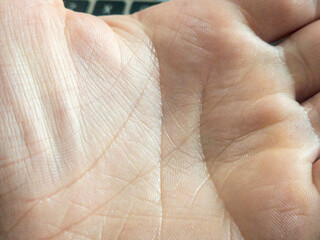 A close-up view of an open palm showcasing textured skin and delicate lines, representing human touch and connection