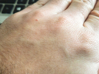 Naklejka premium A close-up view of a human hand resting on a keyboard, showcasing the skin texture and details