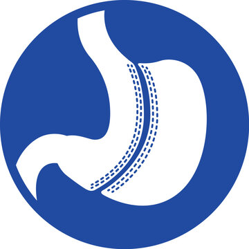 Illustration of stomach icon with bariatric surgery procedure, anatomy. Ideal for medical and educational materials