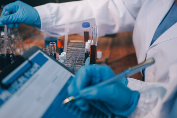 Blood test in the laboratory. Laboratory assistant working with the dispenser. Vacuum tubes with...
