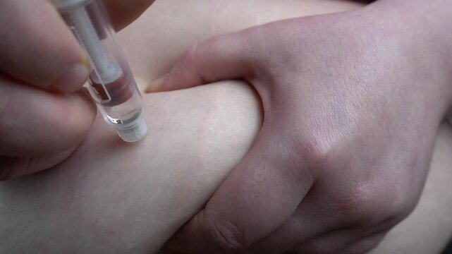 Injections to reduce abdominal weight. Injections of semaglutide or an insulin pen into the abdominal cavity. Injections of drugs for the treatment of diabetes and weight loss.